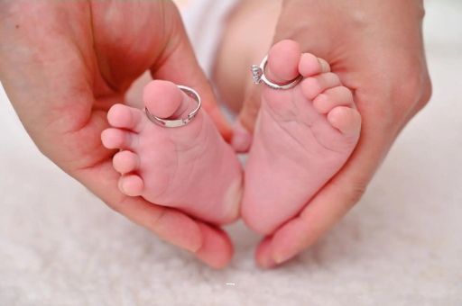 雄安新区孕妇怎样预防妊娠纹 雄安新区孕妇怎样预防妊娠纹